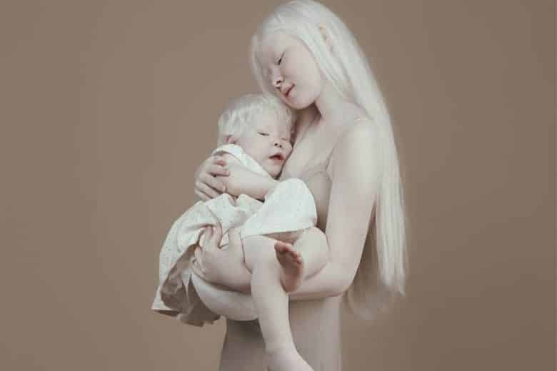 Казахские сестры-альбиносы покорили мир своей удивительной внешностью