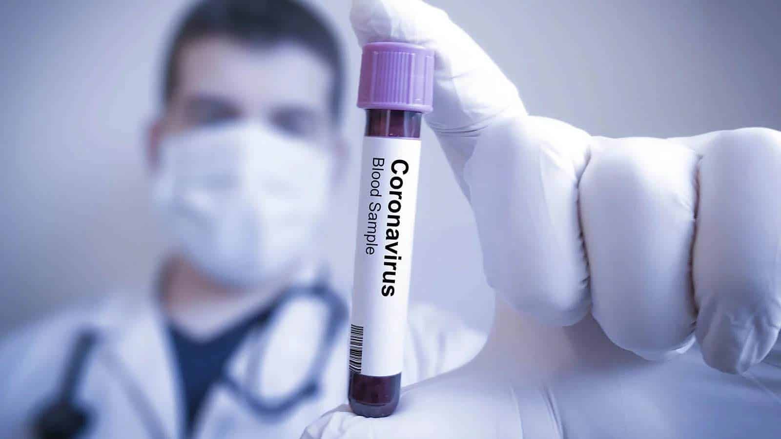 Россию обвинили в сокрытии реальных данных по смертности от коронавируса