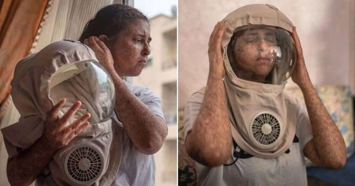 Уже больше 20 лет женщина из Марокко не может появится на улице без специального защитного скафандра