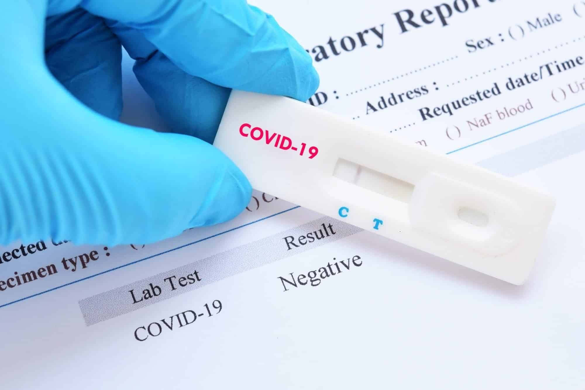 О большом количестве ложных результатов ПЦР тестов на COVID-19 рассказали в Минздраве