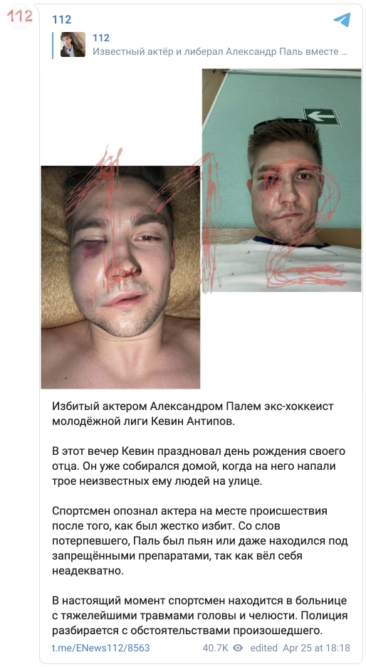 Актера Александра Паля задержала полиция по подозрению в избиении бывшего хоккеиста ЦСКА